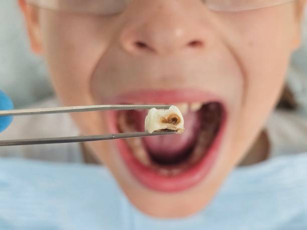 Best Emergency Dentist Near Me  in Parrish, AL