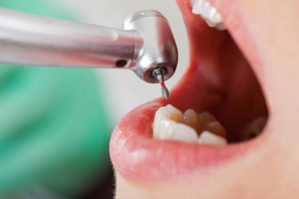 Emergency Dentist for Kids in AL